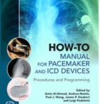 How-to Manual for Pacemaker and ICD Devices