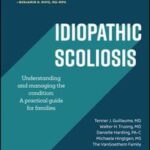 Idiopathic Scoliosis: Understanding and Managing the Condition