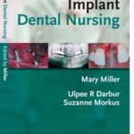 Implant Dental Nursing