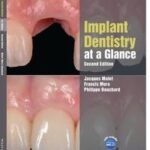 Implant Dentistry at a Glance