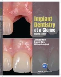 implant-dentistry-glance-2nd-edition-jacques-9781119292609