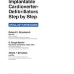 Implantable Cardioverter - Defibrillators Step by Step
