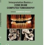 Interpretation Basics of Cone Beam Computed Tomography