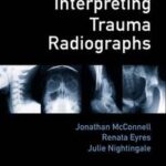 Interpreting Trauma Radiographs