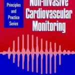 Non Invasive Cardiovascular Monitoring