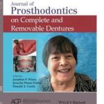 Journal of Prosthodontics on Complete and Removable Dentures