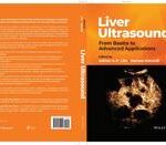 Liver Ultrasound