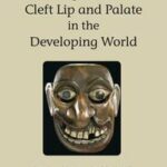 Management of Cleft Lip and Palate in the Developing World