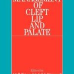 Management of Cleft Lip and Palate