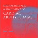 Mechanisms and Management of Cardiac Arrhythmias