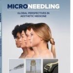 Microneedling