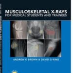 Musculoskeletal X-Rays for Medical Students and Trainees