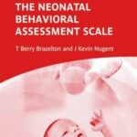 Neonatal Behavioral Assessment Scale