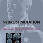Neurostimulation
