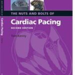 The Nuts and Bolts of Cardiac Pacing
