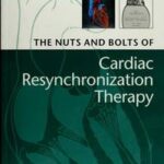 The Nuts and Bolts of Cardiac Resynchronization Therapy