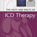The Nuts and Bolts of ICD Therapy