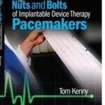 The Nuts and Bolts of Implantable Device Therapy