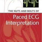 The Nuts and bolts of Paced ECG Interpretation