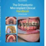 The Orthodontic Mini-implant Clinical Handbook