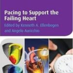 Pacing to Support the Failing Heart