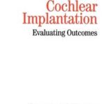 Cochlear Implants