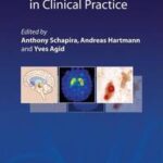 Parkinsonian Disorders in Clinical Practice