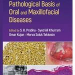 Pathological Basis of Oral and Maxillofacial Diseases