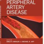 Peripheral Artery Disease