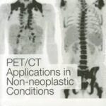 PET CT Applications in Non-Neoplastic Conditions, Volume 1228