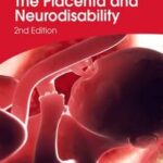 The Placenta and Neurodisability