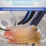 Platelet Rich Fibrin in Regenerative Dentistry