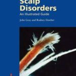 A Pocketbook of Hair and Scalp Disorders