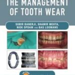 Practical Procedures in the Management of Tooth Wear