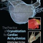 The Practice of Catheter Cryoablation for Cardiac Arrhythmias