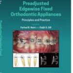 Preadjusted Edgewise Fixed Orthodontic Appliances