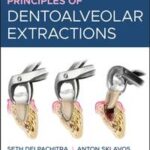 Principles of Dentoalveolar Extractions