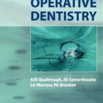 Principles of Operative Dentistry