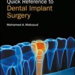 Quick Reference to Dental Implant Surgery