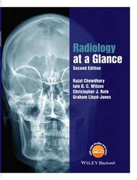 radiology-glance-2nd-edition-rajat-chowdhury-9781118914779
