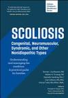 Scoliosis