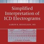 Simplified Interpretation of ICD Electrograms