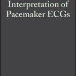 Simplified Interpretation of Pacemaker ECGs