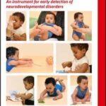 SINDA Standardized Infant NeuroDevelopmental Assessment