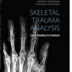 Skeletal Trauma Analysis
