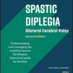 Spastic Diplegia - Bilateral Cerebral Palsy: Understanding and Managing the Condition across the Lifespan