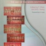 Toothwear