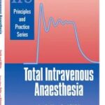 Total Intravenous Anaesthesia