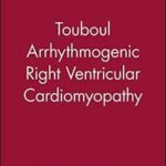 Touboul Arrhythmogenic Right Ventricular Cardiomyopathy