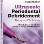 Ultrasonic Periodontal Debridement
